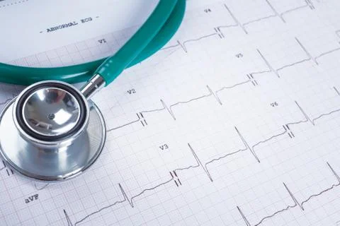 Stethoscope on an electrocardiogram (ECG) chart background Foto stock