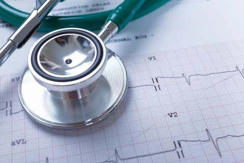 Stethoscope on an electrocardiogram (ECG) chart background Foto stock