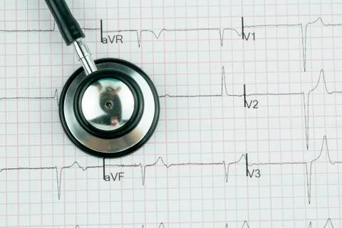 Stethoscope on the electrocardiogram (ECG) graph (top view) Stock Photos