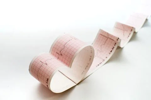 Stethoscope on the electrocardiogram graph Stock Photos