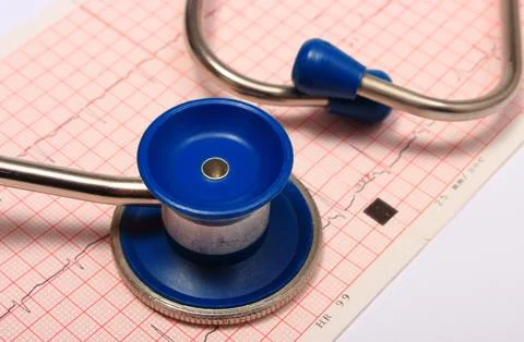 Stethoscope with electrocardiogram graph report Stock Photos