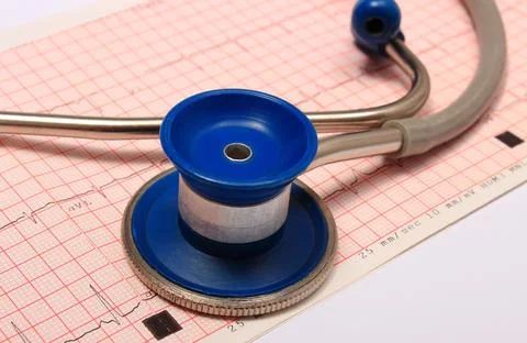 Stethoscope with electrocardiogram graph report Stock Photos