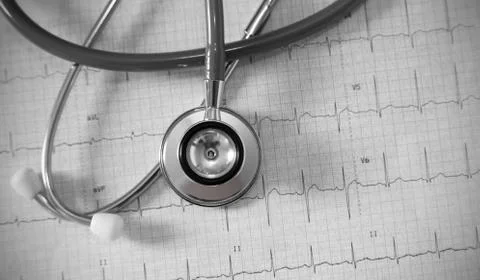 Stethoscope on physical graph paper Stock Photos