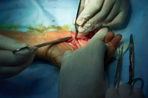 Stitching on the hand Stockfoto's