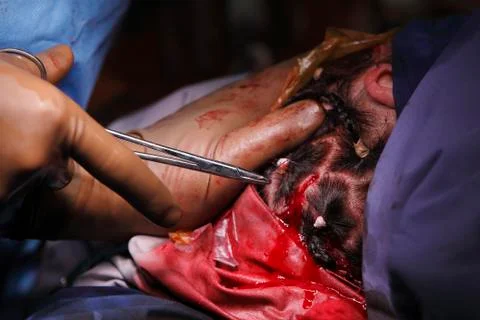 Stitching The Head Skin Stockfoto's