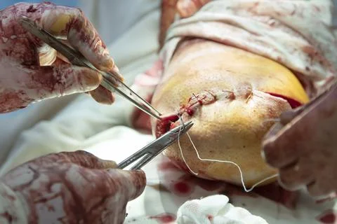 Stitching The Stump CU 写真素材