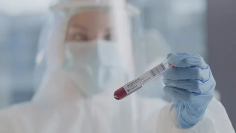 This stock video features a close-up scientist examining a blood sample in a  Stock Footage 137540738