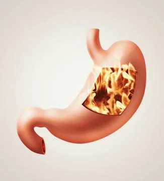 Stomach heartburn concept Stock Illustration