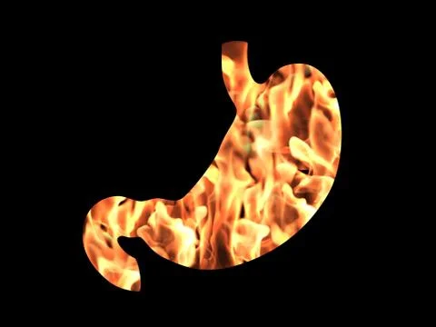 Stomach heartburn concept 스톡 일러스트