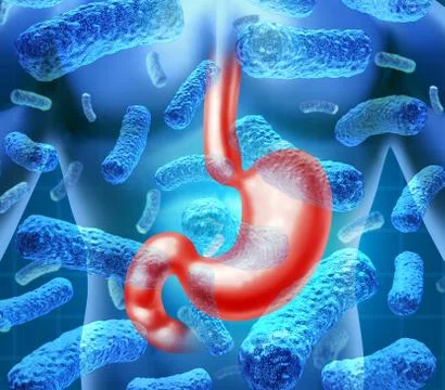 Stomach infection Stock Illustration