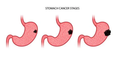 Stomach logo concept Stock Illustration