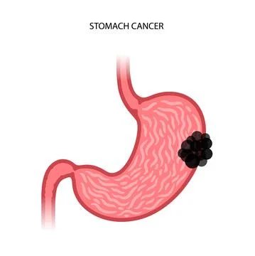 Stomach logo concept Stock Illustration