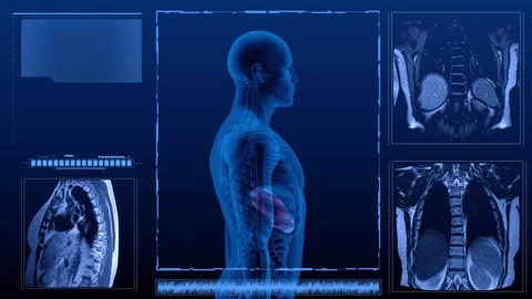 Stomach MRI multi Stock Footage 264153497