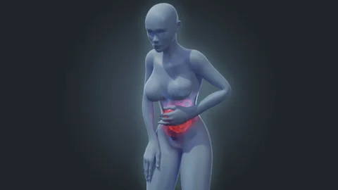 Stomach pain 3D render visualization Stock Footage 247842031