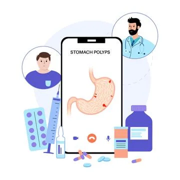 Stomach polyp disease Stock Illustration