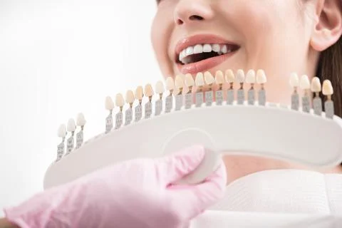 Stomatologist choosing right implants to client Foto stock