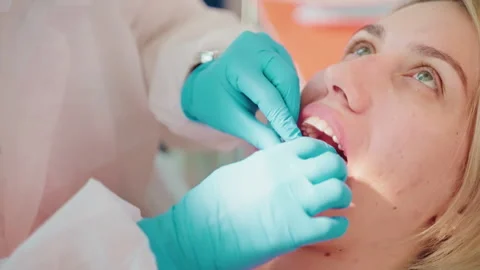 Stomatologist installing clear aligners on teeth of adult woman, technology for Stock Footage 252323278