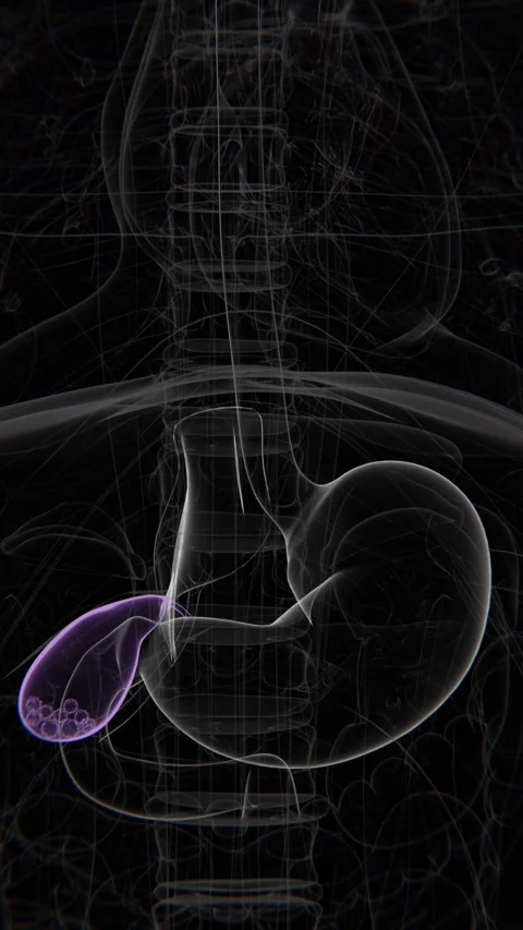Stones in Gall Bladder Vertical Video | Stones in Gall Bladder Vertical Stock Footage 279659283