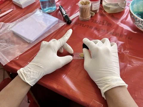 Stool exam, Stool test, Stool examination,OVCCA Stock Photos