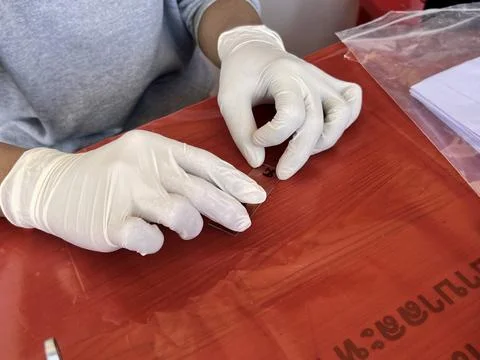 Stool exam, Stool test, Stool examination,OVCCA Stock Photos