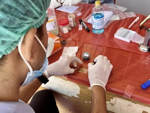 Stool exam, Stool test, Stool examination,OVCCA Stock-Fotos