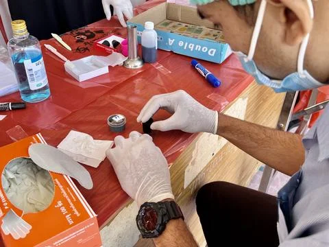 Stool exam, Stool test, Stool examination,OVCCA Stock Photos