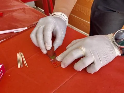 Stool exam, Stool test, Stool examination,OVCCA Stock Photos