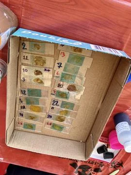 Stool exam, Stool test, Stool examination,OVCCA Stock Photos