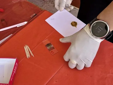 Stool exam, Stool test, Stool examination,OVCCA Stock Photos