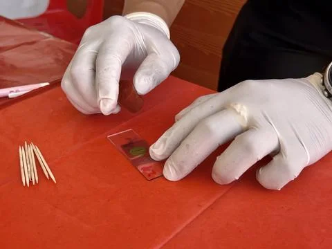 Stool exam, Stool test, Stool examination,OVCCA Stock Photos