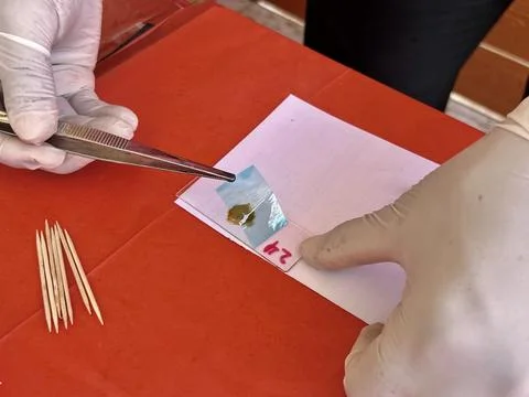 Stool exam, Stool test, Stool examination,OVCCA 写真素材