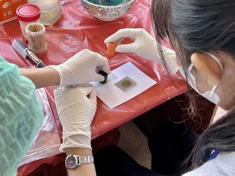 Stool exam, Stool test, Stool examination,OVCCA Stock Photos