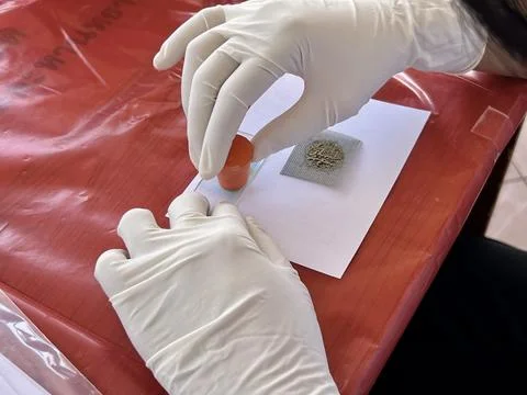 Stool exam, Stool test, Stool examination,OVCCA 스톡 사진