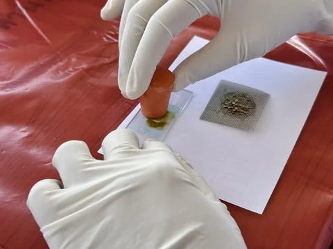 Stool exam, Stool test, Stool examination,OVCCA Stock Photos