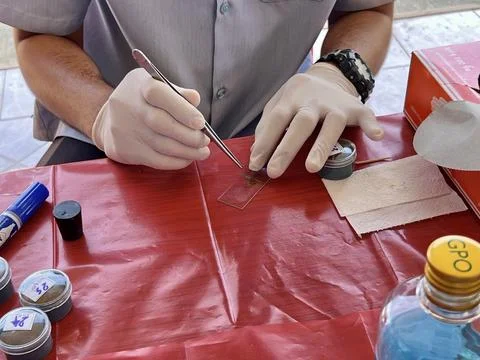 Stool exam, Stool test, Stool examination,OVCCA Stock Photos