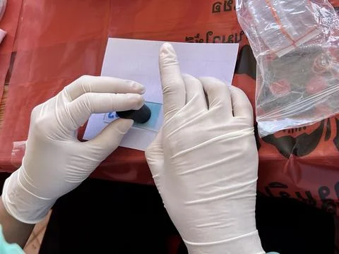 Stool exam, Stool test, Stool examination,OVCCA Stock Photos