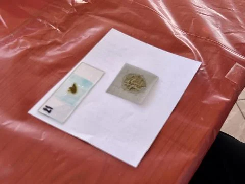 Stool exam, Stool test, Stool examination,OVCCA Stock Photos