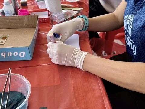 Stool exam, Stool test, Stool examination,OVCCA Stock Photos