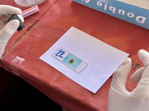 Stool exam, Stool test, Stool examination,OVCCA Stock Photos