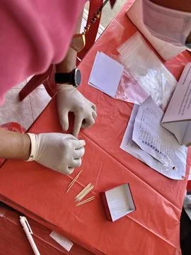 Stool exam, Stool test, Stool examination,OVCCA Foto stock