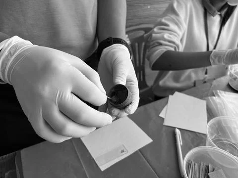 Stool exam, Stool test, Stool examination,OVCCA Foto stock