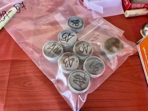 Stool exam, Stool test, Stool examination,OVCCA Foto stock