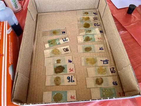 Stool exam, Stool test, Stool examination,OVCCA Stock Photos