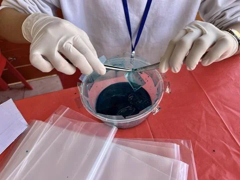 Stool exam, Stool test, Stool examination,OVCCA Stock Photos