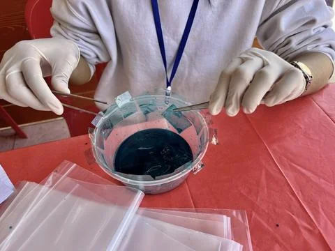 Stool exam, Stool test, Stool examination,OVCCA Stock Photos