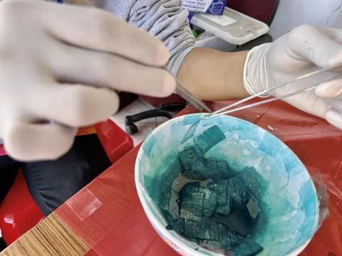 Stool exam, Stool test, Stool examination,OVCCA Stock Photos