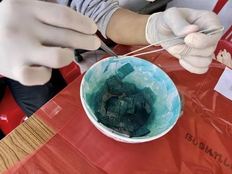 Stool exam, Stool test, Stool examination,OVCCA Stock-Fotos