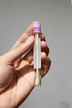 Stool test with samples inside. Stock Photos