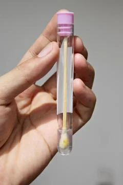 Stool test with samples inside. Stock Photos