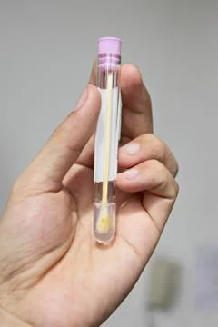 Stool test with samples inside. Stock Photos